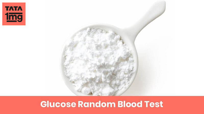 Glucose - Random